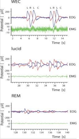 斯坦福博士告诉你:清醒梦*行为性**真的存在吗?