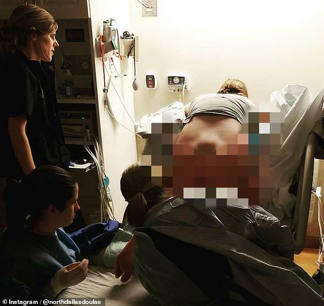 你能看到她后背的凸起吗?状似菱形,这是生理性分娩重要组成部分