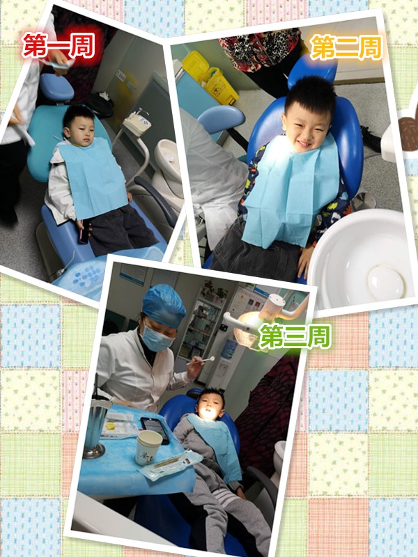 做了窝沟封闭还会蛀牙,蛀齿还需要做窝沟封闭吗