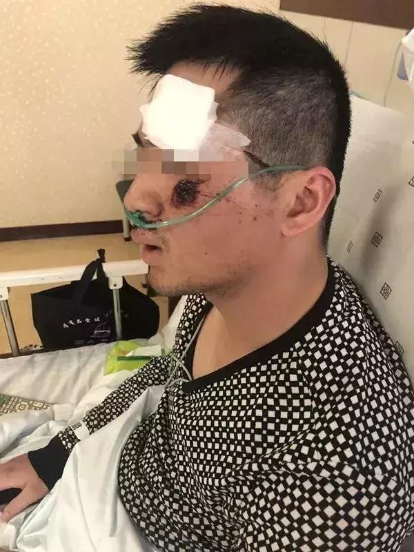 冲卡逃避交警检查被交警打了,男子酒驾遇查强行冲撞辅警被判刑