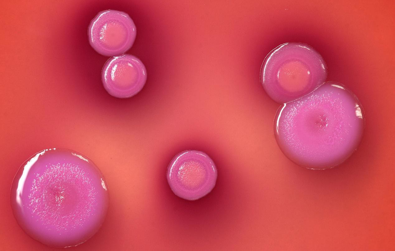 频繁挖鼻孔险丧命,长期挖鼻孔注意事项