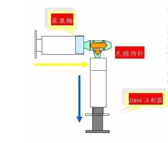 picc发生堵管的原因,picc堵了再重开有危险吗
