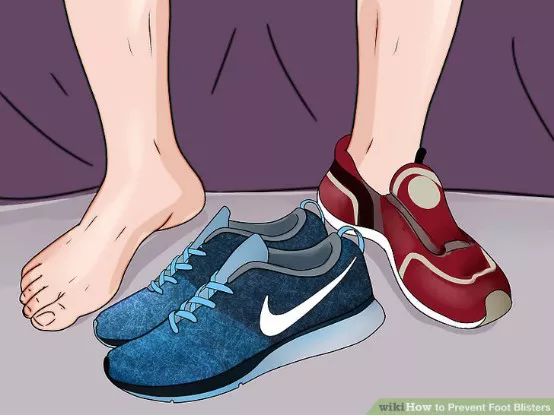 如何预防与处理比跑步膝痛还烦人的水泡？