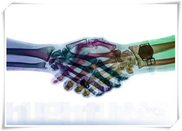 握手、亲吻、喝水、高跟鞋！X射线下人体的样子是啥样？