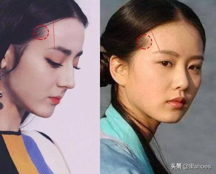 如何改善自己的脸型提升颜值,脸型真的很重要它决定你的颜值