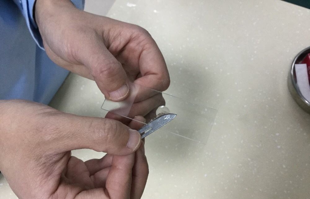 人得了猫癣怎么防止它越长越多 (猫病猫藓)