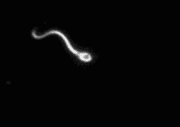 跑得最快、最阳刚的精子才能受精成功？不！它只是运气好而已