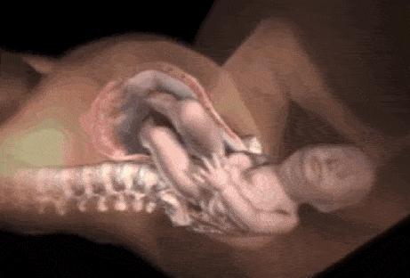 屁股大骨盆条件就好吗,屁股大好生养粤语怎么说