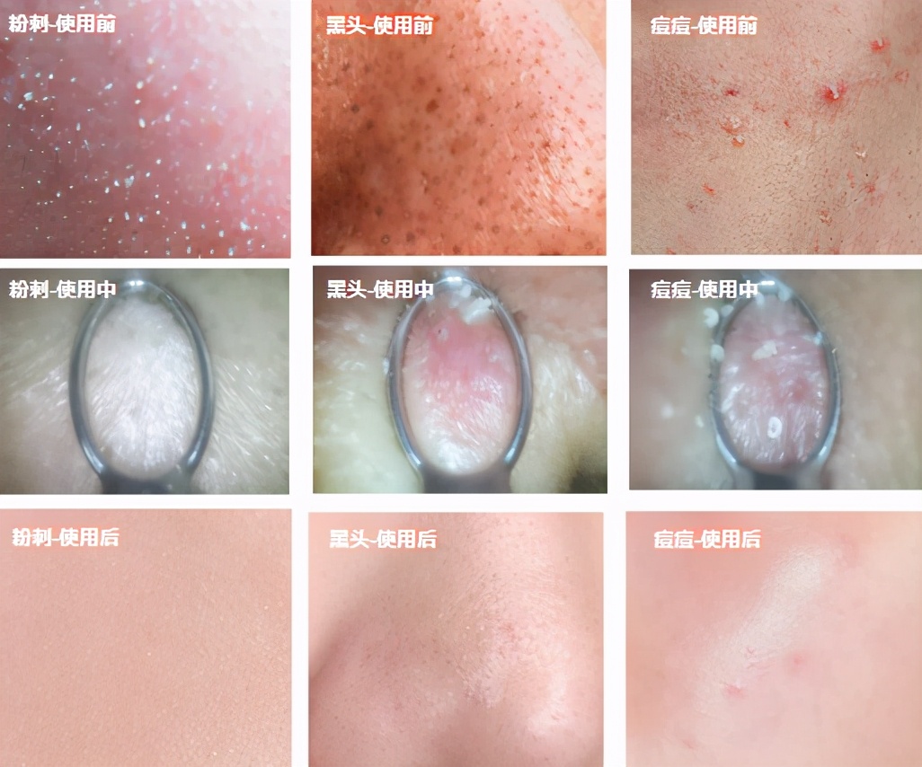 小米有品击破行业暴利！99元搅局万亿市场，宙斯松下：不香了