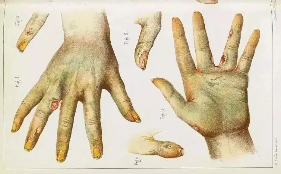 影视里绿色的毒药图,影视剧常见毒药