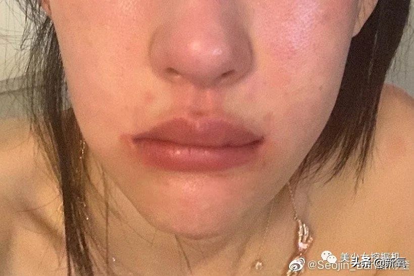 潘南奎被打事件,潘南奎被殴打