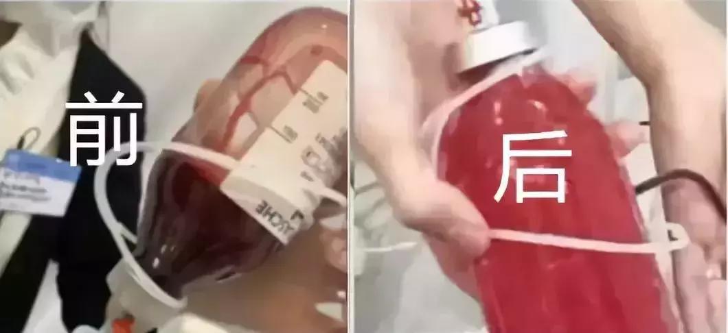 血液净化排毒,血液净化美容有作用吗