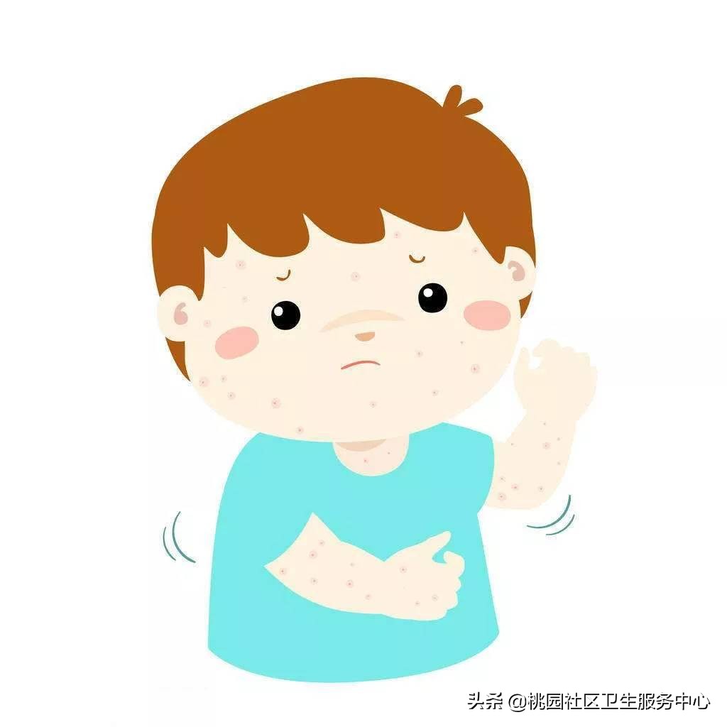 关于水痘高发期的注意事项,水痘的坑怎么消