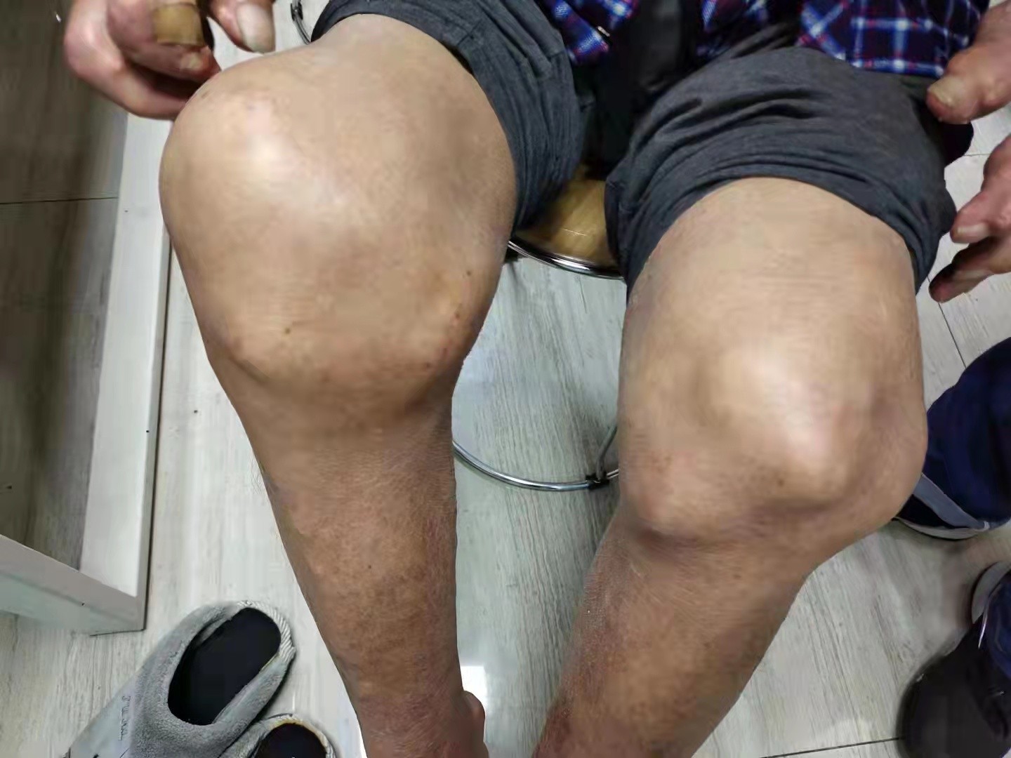 中华医学会风湿分会会员陈乐天名医工作室在贵阳强直医院揭牌成立