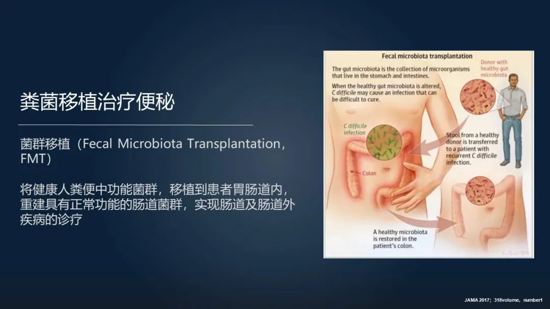 一招调理肠道改善便秘,肠道水疗治便秘有效吗