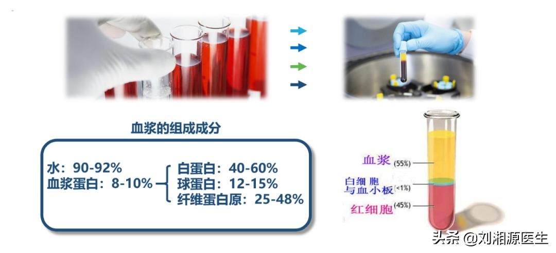 丙种球蛋白妊娠,静脉注射免疫球蛋白保胎
