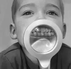 孩子长双层牙怎么回事,孩子长双层牙