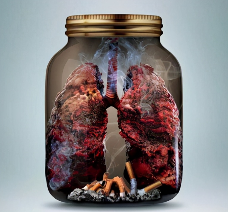 吸烟30年的肺戒烟后的变化,戒烟以后多久肺会恢复变白