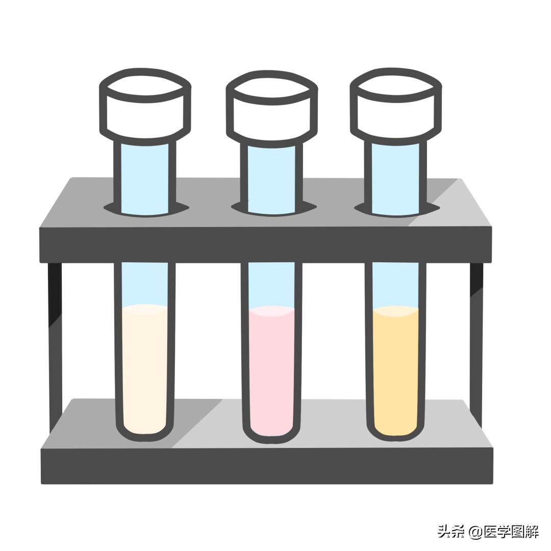 精子检测的结果怎么看懂,精子检测报告如何看懂