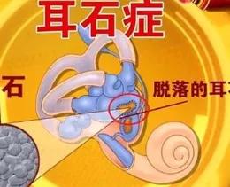 鱼头里面的白色的石头,鱼头有两块小石头