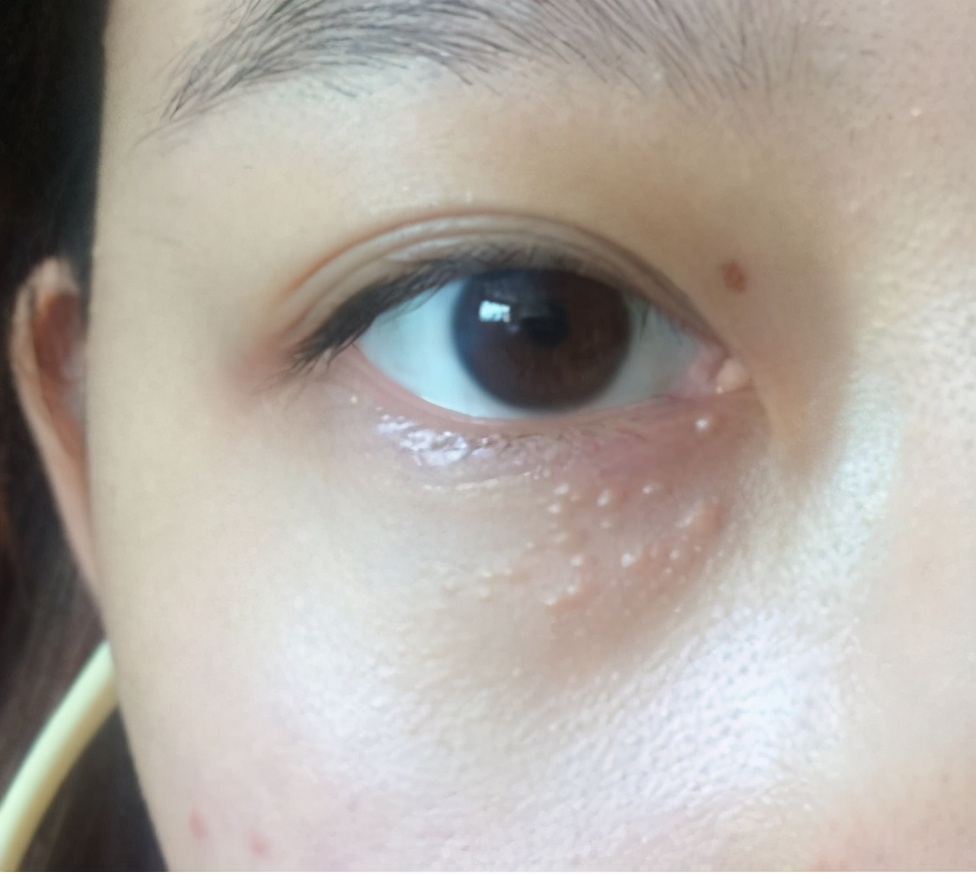 小儿皮肤护理知识大全,宝宝皮肤护理知识大全