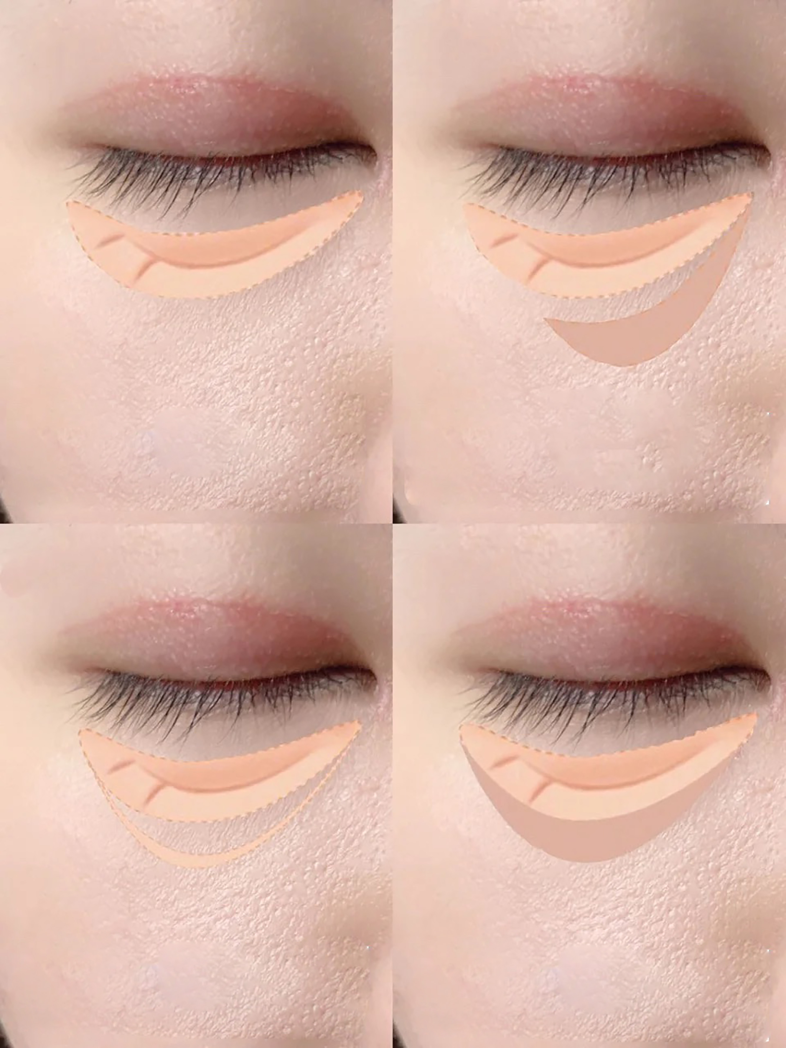 15秒了解眼睛有疾病,120秒轻松解决眼部问题