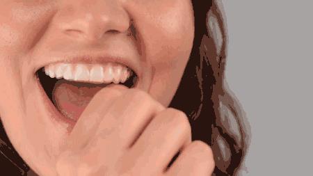 三种牙套大PK，优势对比一目了然