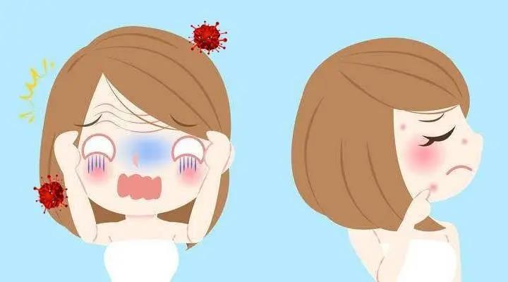 冬天不长痘夏天脸上长痘怎么回事,更年期脸上老是长痘痘怎么消除