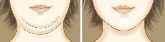 教你三招告别双下巴动作,双下巴怎么减最快最有效