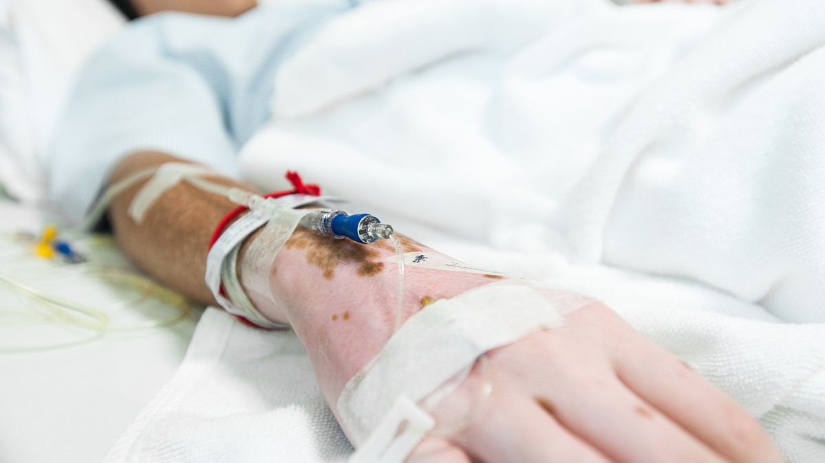 白癜风顽固难治该怎么办才好,稳定了十几年的白癜风需要治疗吗