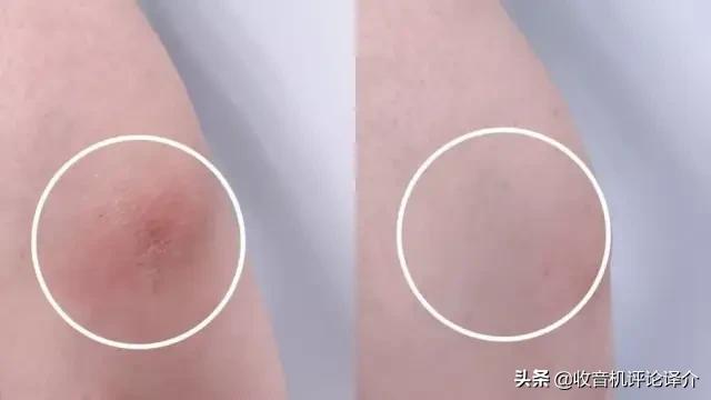 泰国发明的去角质慕斯火了!搓一搓脏东西就出来,脸上干净又白嫩