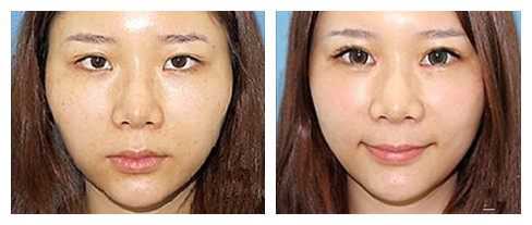 穿黑色衣服特别难看,适合夏天穿的黑色系穿搭