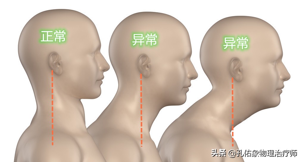 颈椎病引起的手麻颈肩痛怎么治疗,颈肩痛除了颈椎病还有哪些病