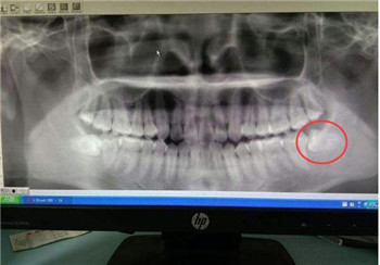 不要自己吓自己！胎宝宝比你想象中要坚强
