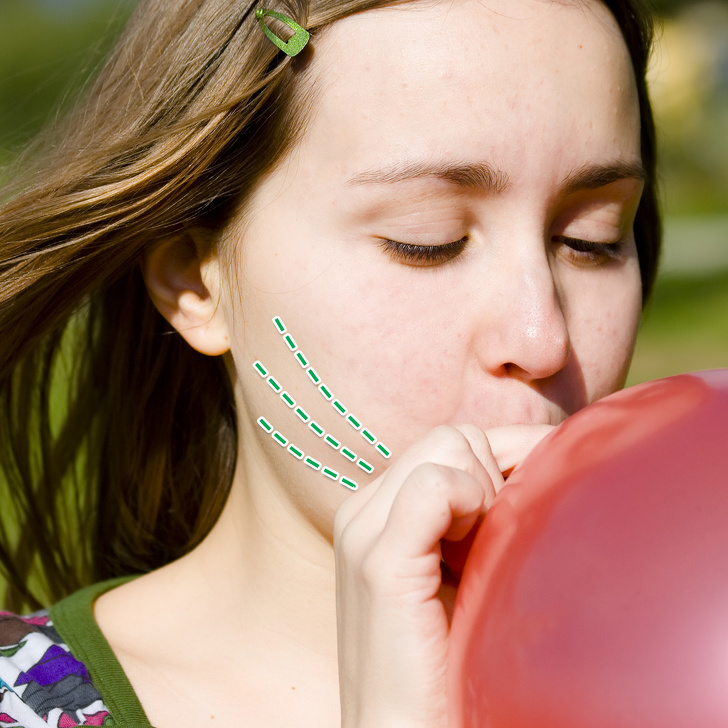 减少面部赘肉,减少面部双颊脂肪的医美项目