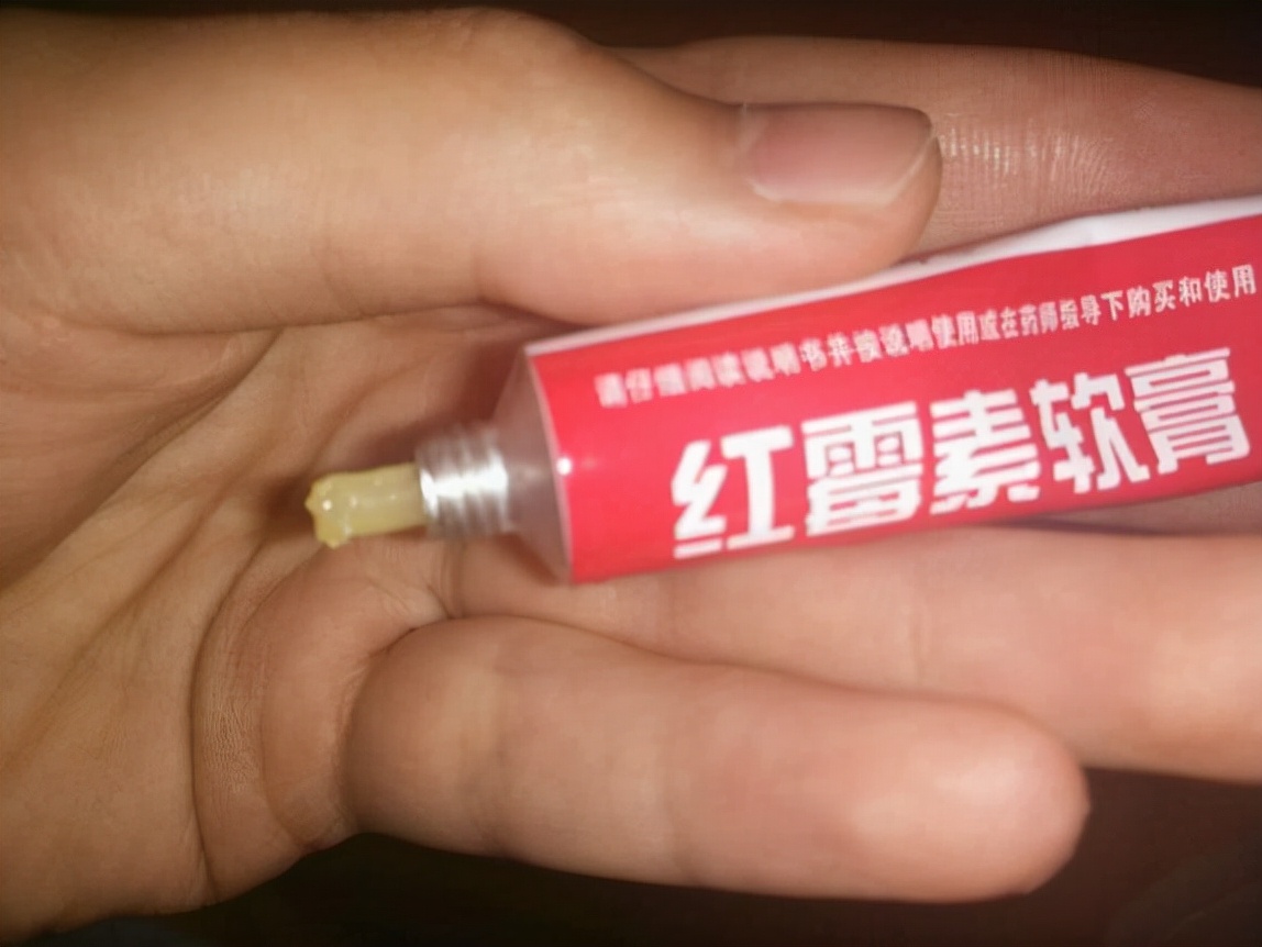 红霉素软膏作用与功效能治脚气吗,2块钱一支的红霉素