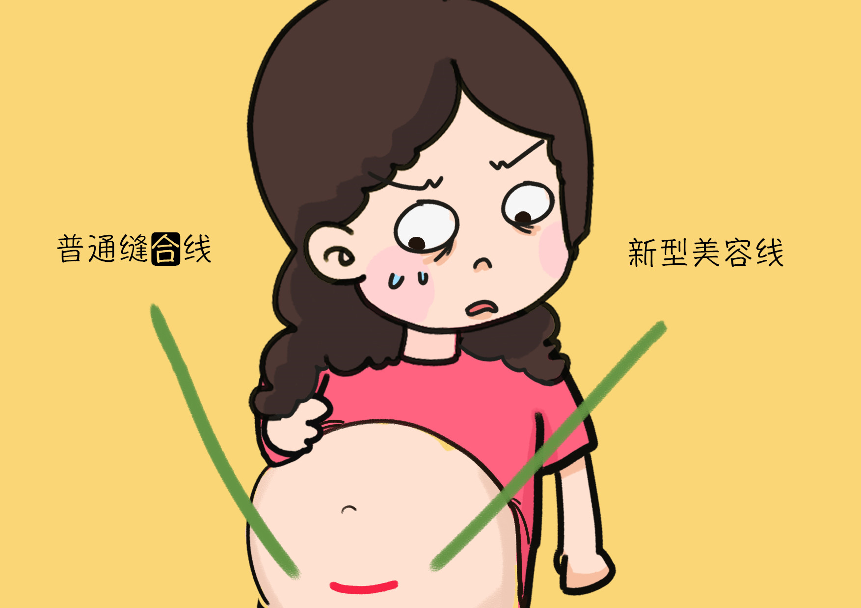 为什么剖腹产不用缝线了,为什么现在剖宫产不用拆线