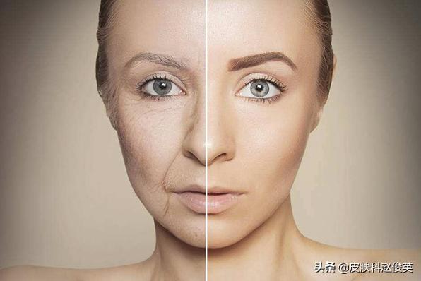 想要年轻皮肤好,胶原蛋白不可少,补它