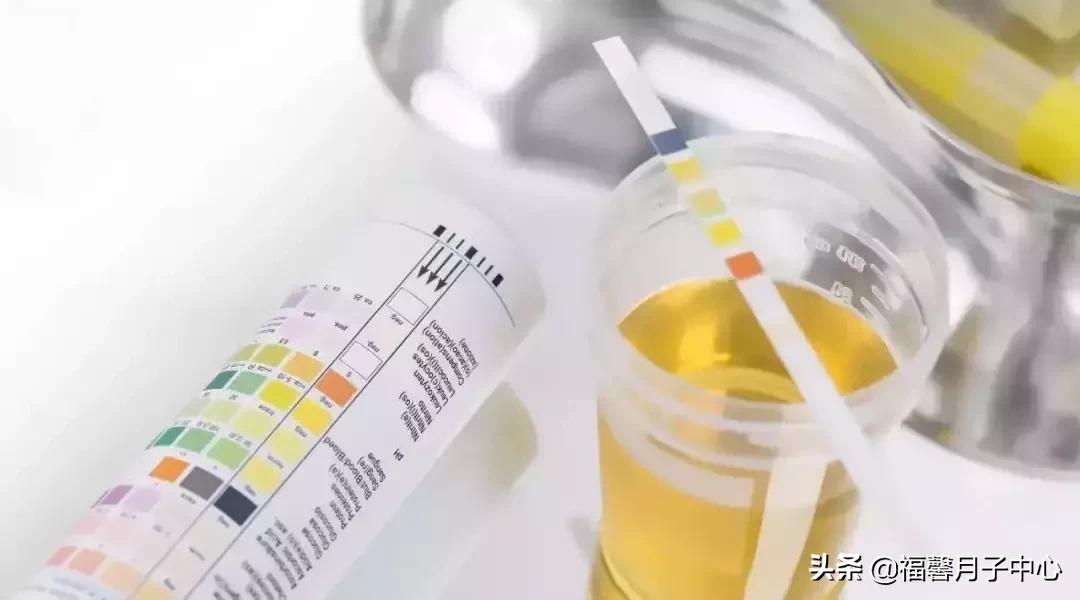 34周了产检每次都要验尿嘛,为什么每次产检都要验尿