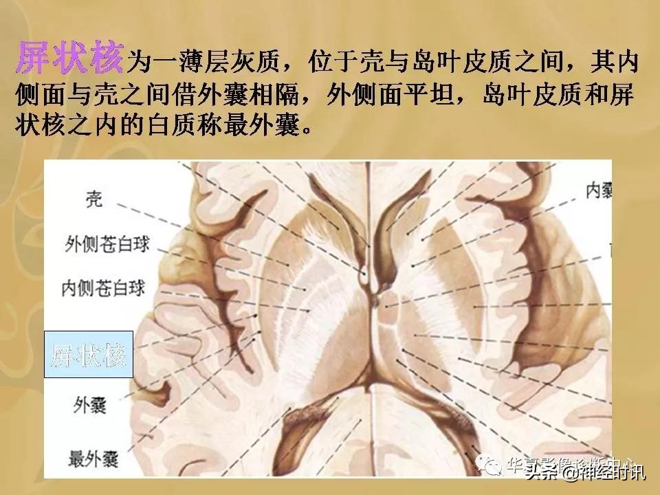 基底节ct解剖示意图,影像解剖图谱怎么用
