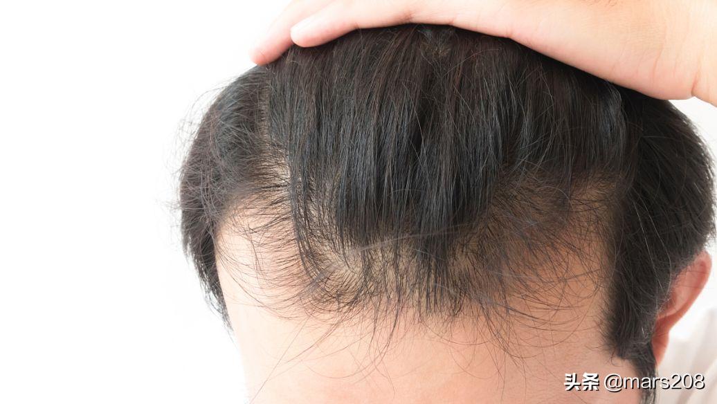 保护发际线的洗发水测评,保护发际线洗发水测评