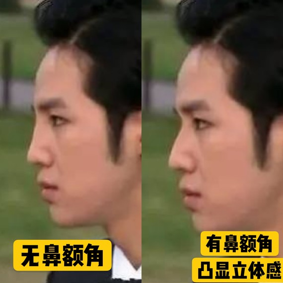 好看的鼻子类型驼峰鼻,好看的鼻型有哪几种