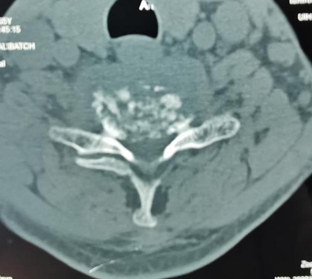 锦州市第二医院骨科,锦州市第二医院脊柱骨科门诊