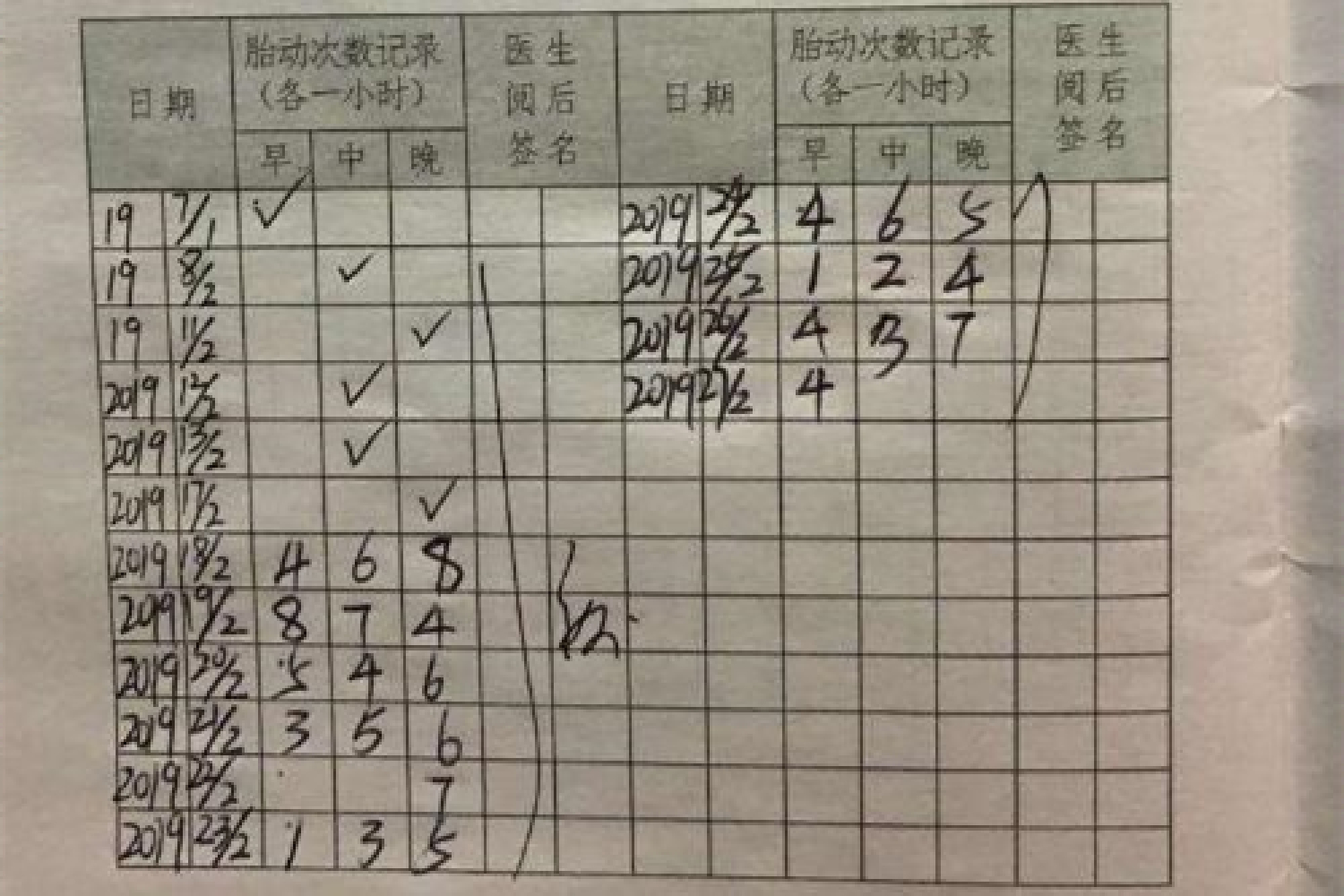 孕期各种胎动像什么,孕期每个阶段胎动都会不一样