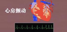 冠心病小红书——治疗的ABCDE
