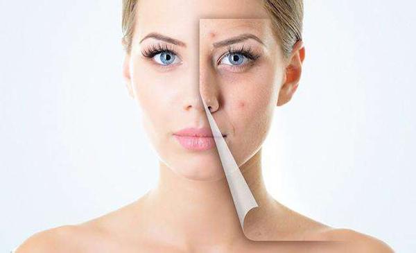 戴口罩过敏脸部起皮怎么办,戴口罩脸脱皮干燥发红是怎么回事