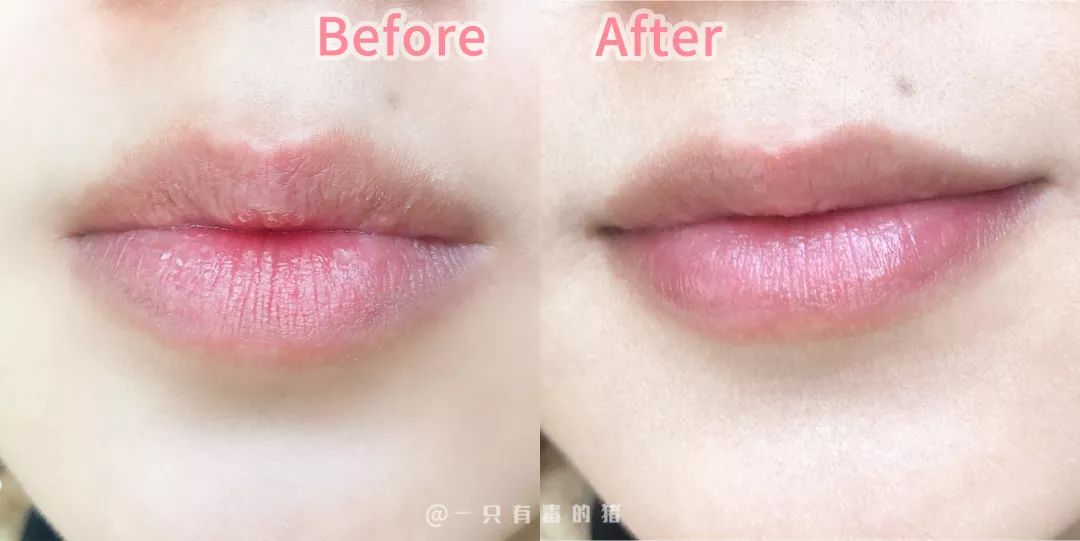 空管润唇膏,润唇膏空管