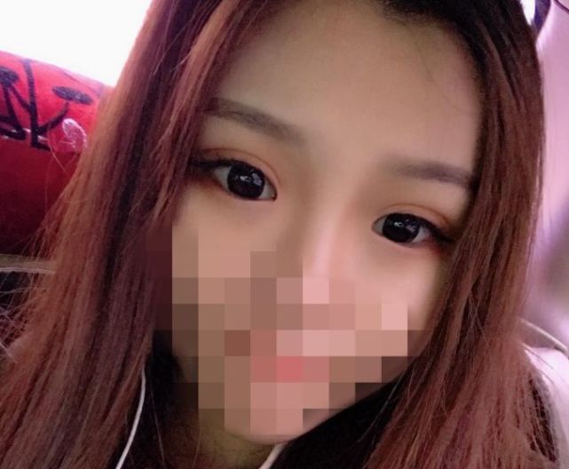 医生说我不适合做线雕,医生说我不适合做飞秒手术