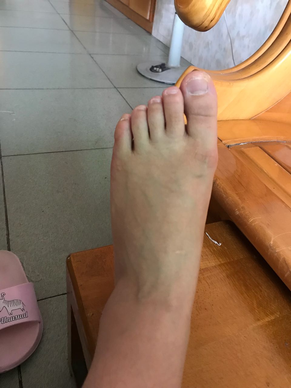 脚宽可以做窄吗,脚跟太宽穿什么鞋子