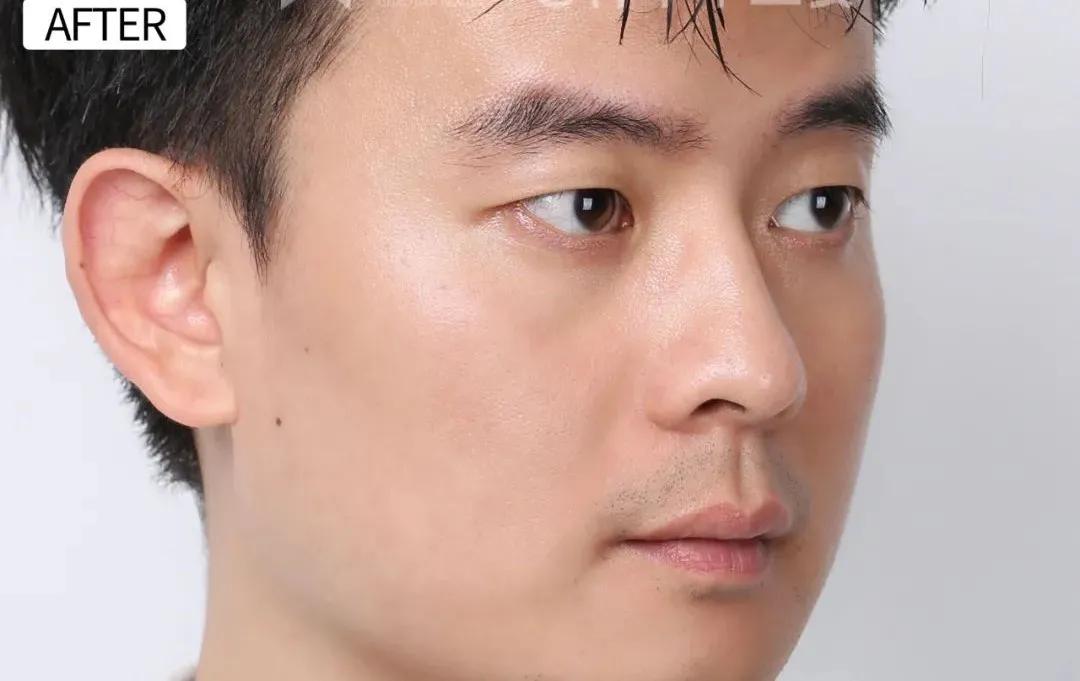 效果最好的熬夜面膜,去闭口熬夜最适合用的面膜